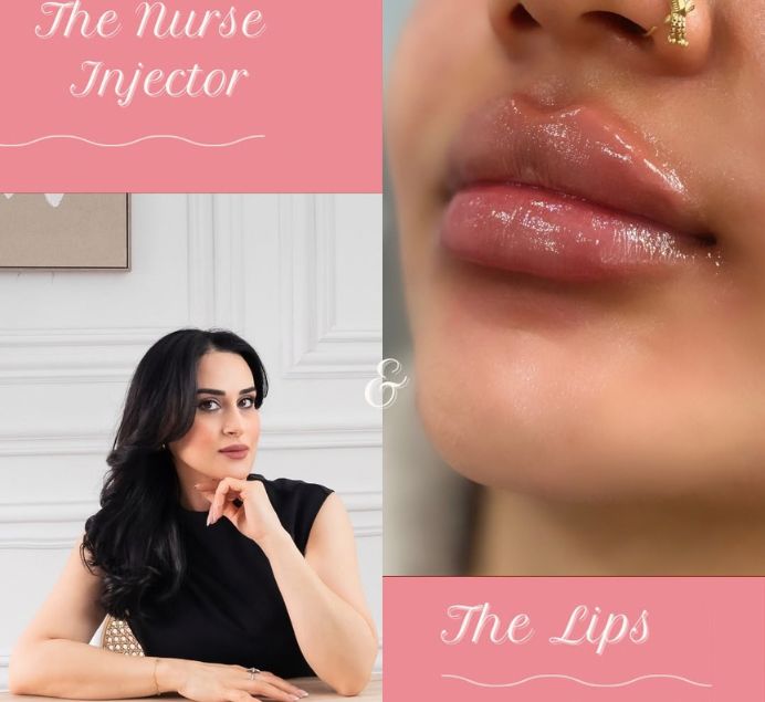 Dermal-Filler-Lips-Results
